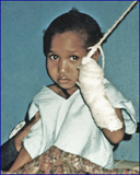 Girl with arm injury